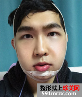 网红脸,套餐,你们猜,多少钱