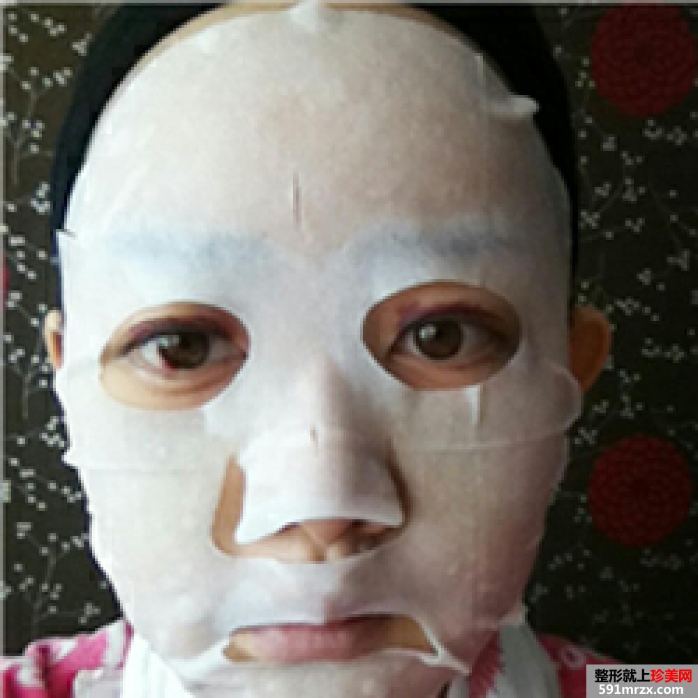 妹子颧骨颧弓内推手术恢复过程分享，还有前后对比效果图片哦！