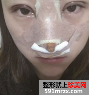 图片2.png