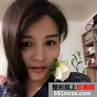 超声刀美容前后照片 北京叶子超声刀案例分享