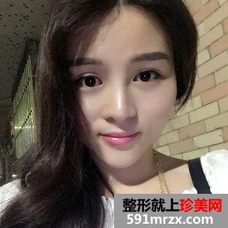 超声刀美容前后照片 北京叶子超声刀案例分享