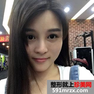 超声刀美容前后照片 北京叶子超声刀案例分享