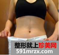 北京清木腰腹部吸脂恢复日记