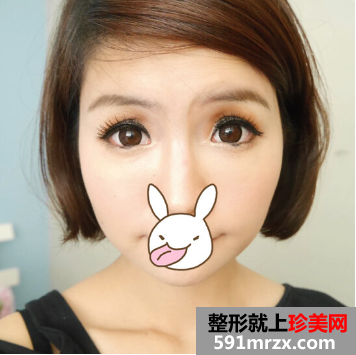 熬过怀孕哺乳期 我来到成都赵博士整形美容打瘦脸啦