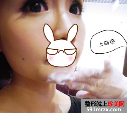 熬过怀孕哺乳期 我来到成都赵博士整形美容打瘦脸啦