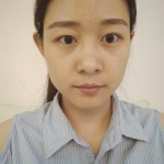爱美的丫头的日记分享 术前图1