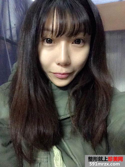 上海华美脂肪填充