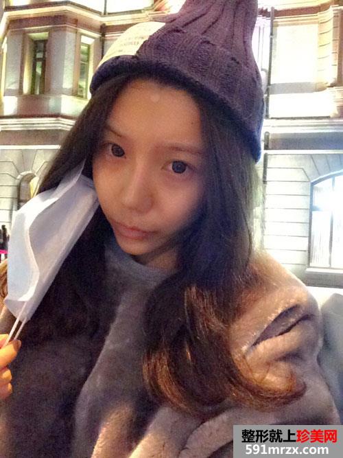上海华美脂肪填充
