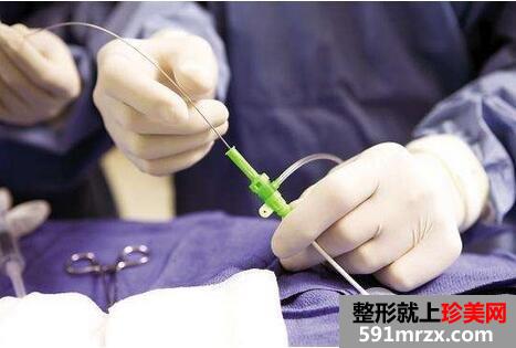 内窥镜假体隆胸需要多少钱 内窥镜隆胸手术的效果图