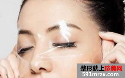 额部除皱术要多少钱 玻尿酸额部除皱效果怎么样