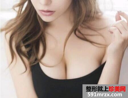 武汉自体脂肪隆胸多少钱