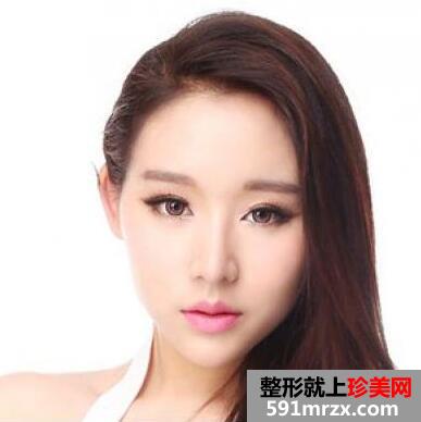 南通自体脂肪面部填充要多少钱