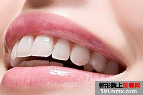 广州烤瓷牙价格表