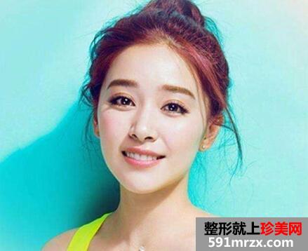 深圳垫个鼻子多少钱