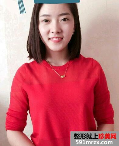 做完韩式三点恢复过程图