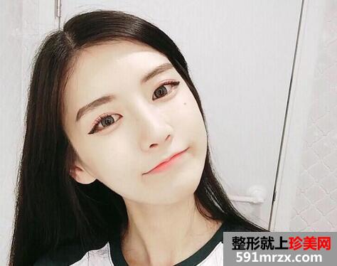 佛山垫个鼻子一般要多少钱