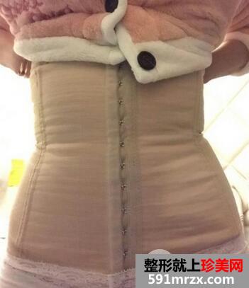 腰腹环吸效果好吗 亲身经历告诉你