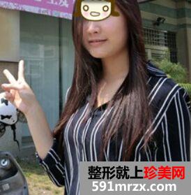 一个午休时间就做了三项微整形 变得美美哒!