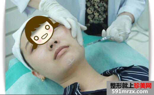 一个午休时间就做了三项微整形 变得美美哒!