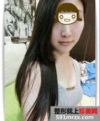 一个午休时间就做了三项微整形 变得美美哒!