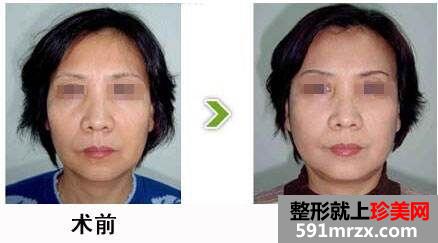 上海万丽医疗美容门诊最可靠价格表曝光