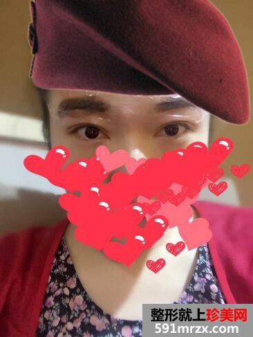 韩式半永久纹眉后不用再画眉啦