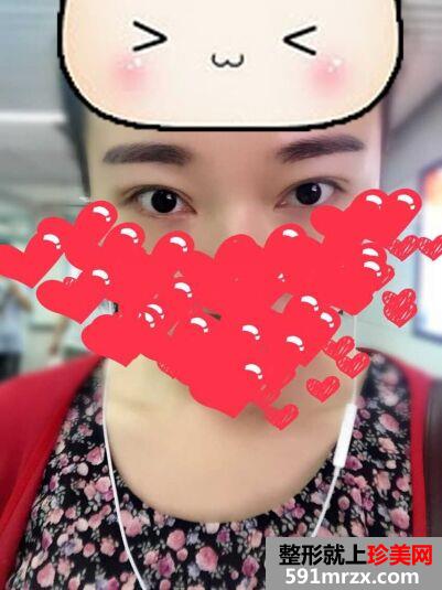 韩式半永久纹眉后不用再画眉啦