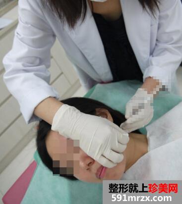 瘦脸前后对比图
