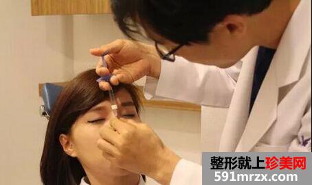 玻尿酸隆鼻后鼻梁立马变高挺~