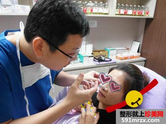 做完Misko隆鼻 颜值提升了许多