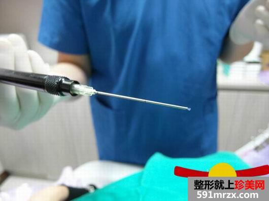 做完Misko隆鼻 颜值提升了许多