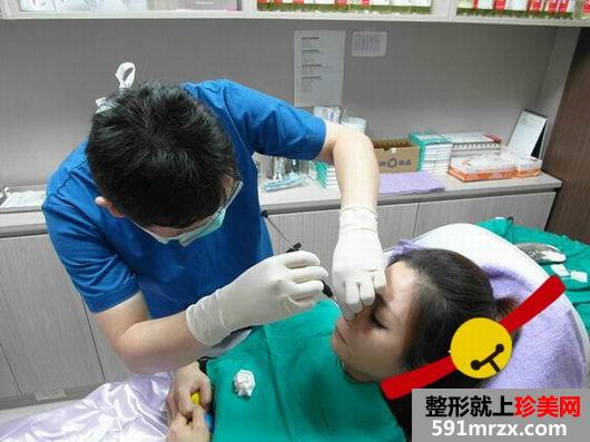 做完Misko隆鼻 颜值提升了许多