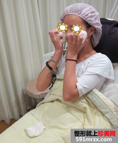 玻尿酸丰苹果肌+填充泪沟让宝妈恢复美丽面容