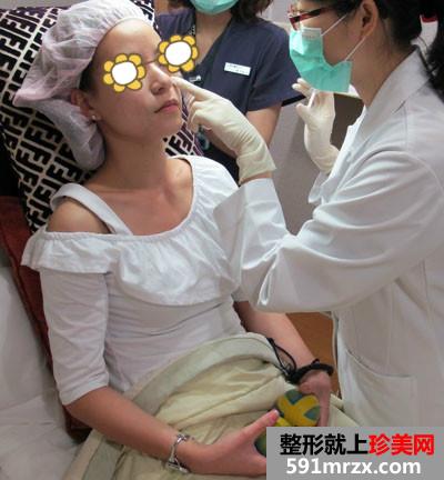 玻尿酸丰苹果肌+填充泪沟让宝妈恢复美丽面容