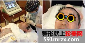 极线音波拉皮后大叔变小年轻