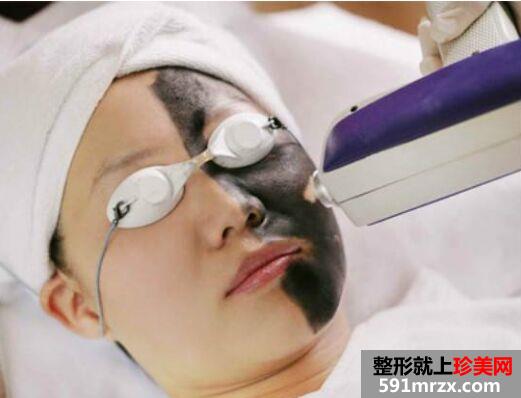 黑脸娃娃多少钱一次 黑脸娃娃效果图
