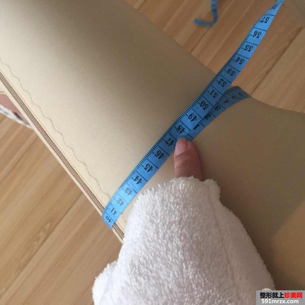 水动力吸脂瘦大腿亲身经历分享，快速拥有小细腿