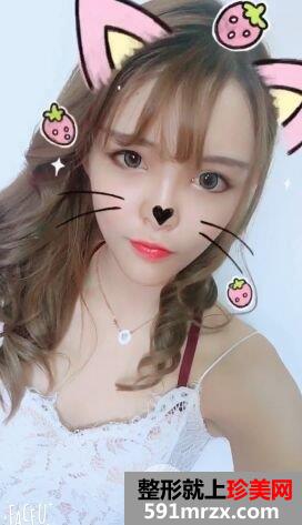 全面部自体脂肪填充手术过程分享，谁能说我不是少女