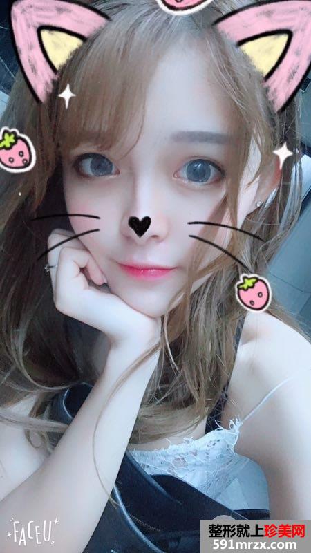 全面部自体脂肪填充手术过程分享，谁能说我不是少女