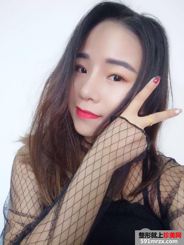 瘦脸针+综合鼻整形案例效果对比图变化惊人