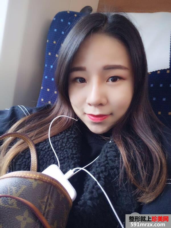 瘦脸针+综合鼻整形案例效果对比图变化惊人