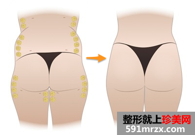 合肥博士整形医院价格表全新爆出