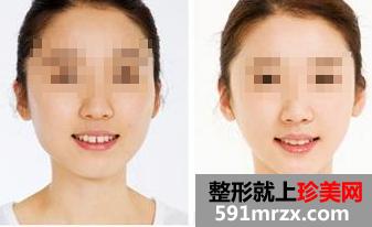 武汉美之仁整形医院价格表全新上线