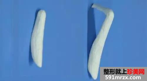 沈阳隆鼻价格表全新爆出