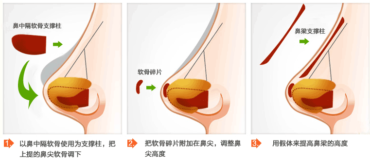 上海华美整形医院价格表一览曝光