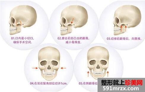 四川华美紫馨整形医院价格表一览出炉