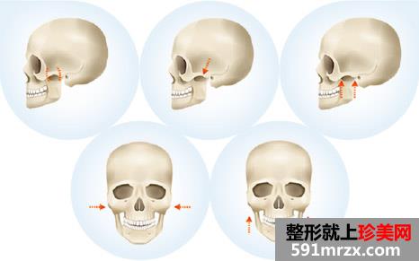 民航上海整形医院价格表一览曝光