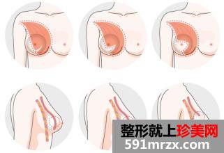 上海伊美尔港华整形医院新价格表一览