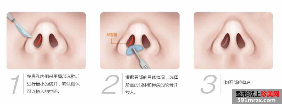 武汉绎君医疗美容医院全新价格表火热出炉