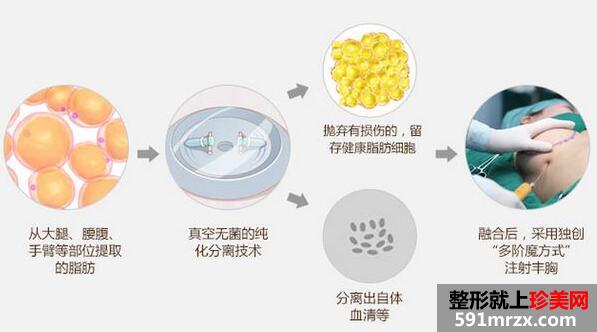 北京东方和谐整形医院全新价格表出炉